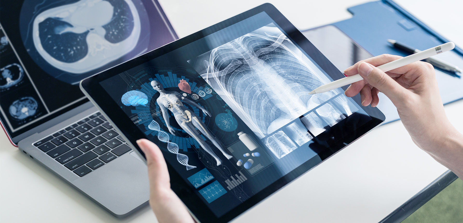 Over-the-shoulder view of someone looking at an X-ray